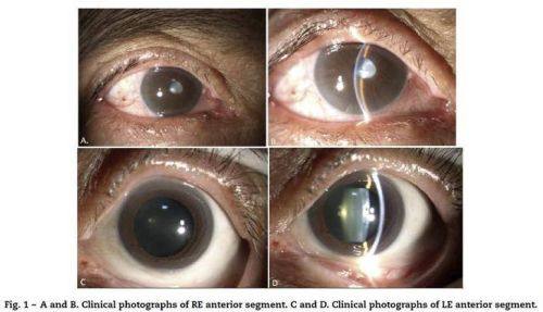 汕头眼管家眼科门诊部特色项目及技术优势