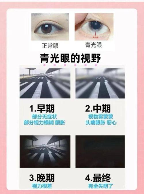 东莞市松山湖中 心医院眼科是正规医院吗？