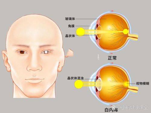 汕头眼管家眼科门诊部地址电话营业时间