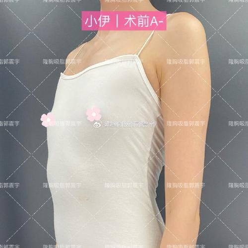 玉林市红十字会医院整形科地址电话营业时间