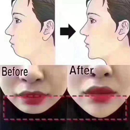 玉林市红十字会医院整形科特色项目及技术优势