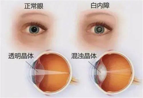 哈尔滨明康视眼科门诊有限公司详细的预约挂号方式及流程