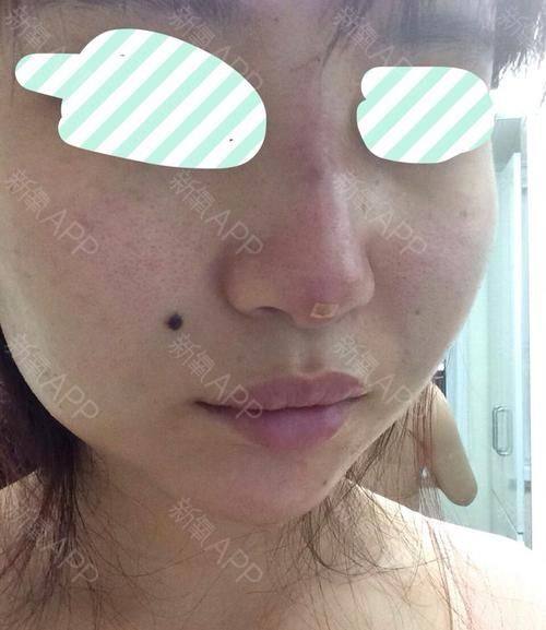 厦门湖里天伦整形医院真人口碑评价怎么样？