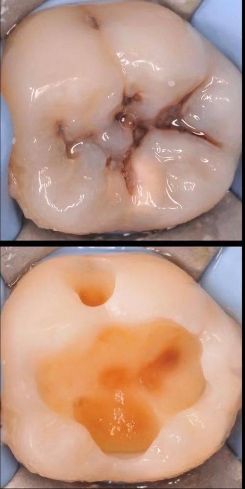 维多利亚口腔特色项目及技术优势