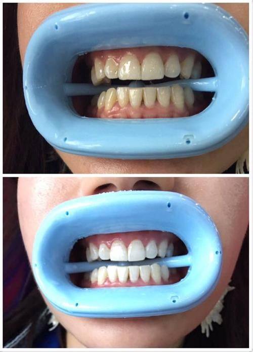 江苏无锡品善口腔门诊部真人口碑评价怎么样?