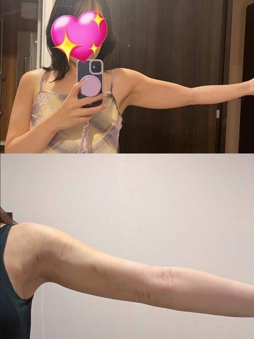 韩国N-Slim吸脂医院详细的预约挂号方式及流程