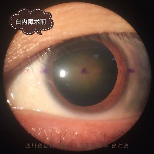 牡丹江市第二人民医院眼科真人口碑评价怎么样?