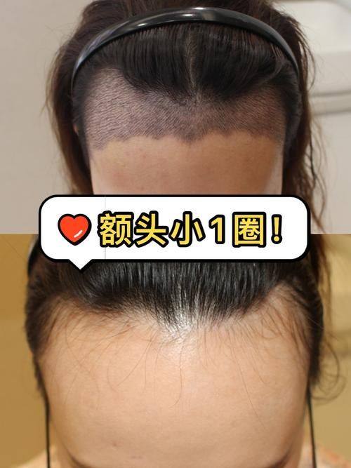 泰国TARA整形医院收费价格表/收费标准