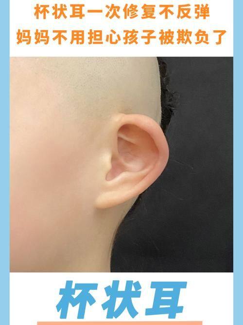 厦门湖里天伦整形医院是正规医院吗？