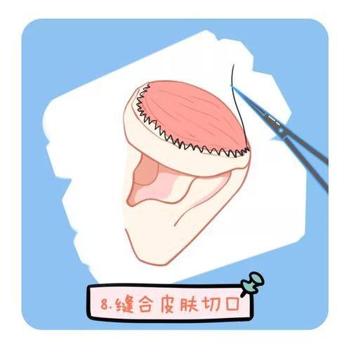 厦门湖里天伦整形医院地址电话营业时间