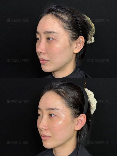 扬州韩美整形真人口碑评价怎么样？