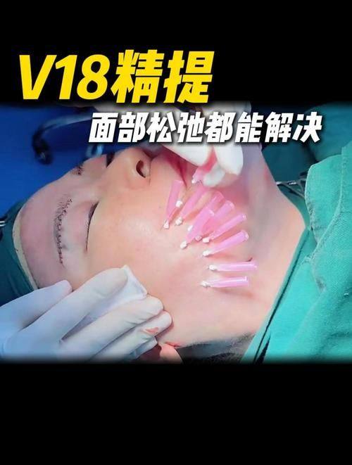 厦门湖里天伦整形医院收费价格表/收费标准