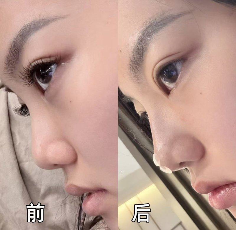 扬州韩美整形收费价格表/收费标准