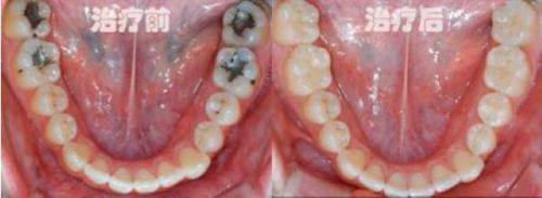 长沙叶先勇口腔诊所收费价格表/收费标准