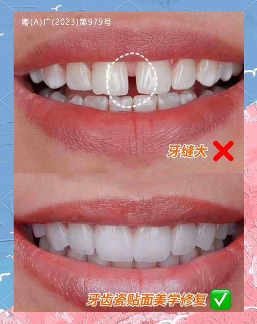 山东烟台和美口腔门诊部特色项目及技术优势