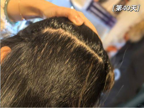 西安碑林科 大植发医院真人口碑评价怎么样?