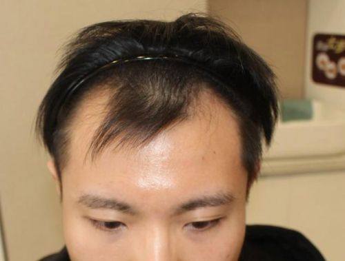 西安碑林科 大植发医院是正规医院吗?