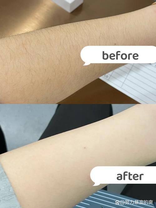 韩国Beauty Lounge Clinic皮肤科是正规医院吗?