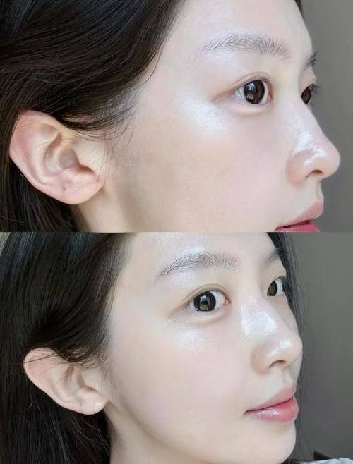 韩国pangpang皮肤科详细的预约挂号方式及流程