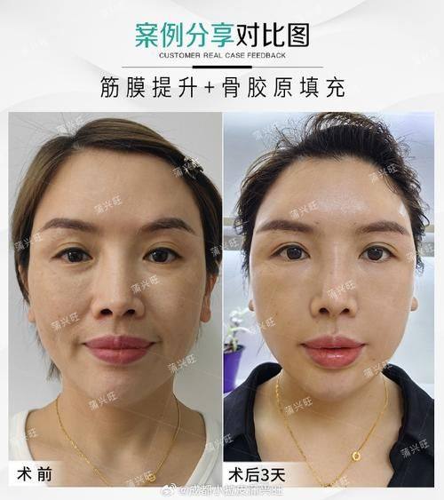 韩国pangpang皮肤科收费价格表/收费标准