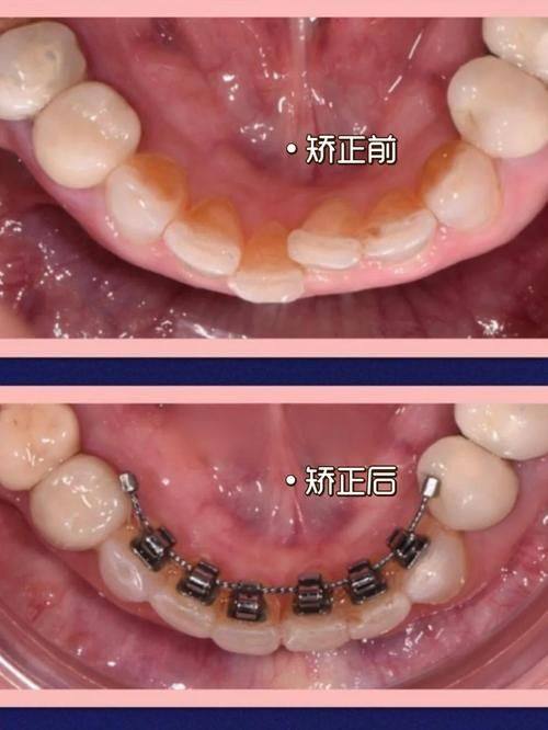 山东烟台和美口腔门诊部收费价格表/收费标准