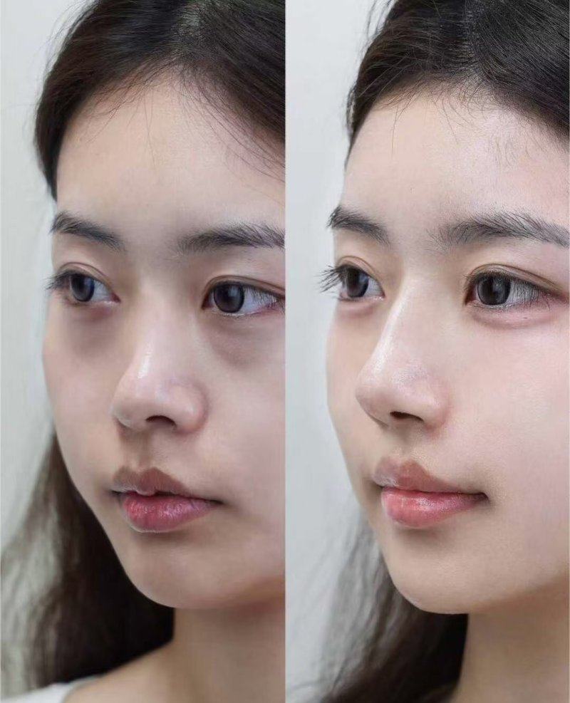 韩国Beauty Lounge Clinic皮肤科收费价格表/收费标准