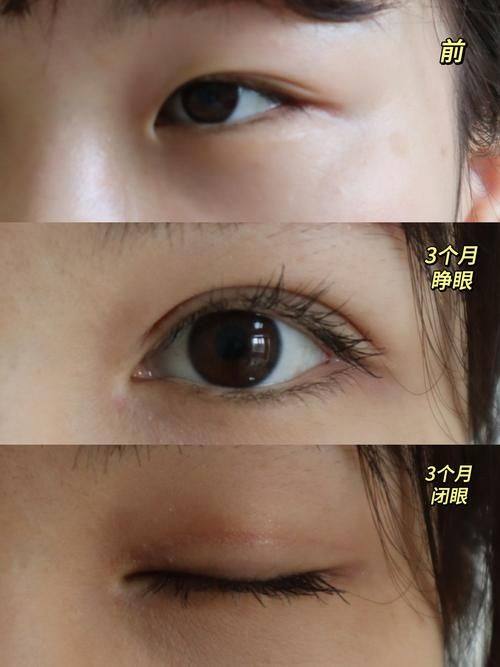 广州王莹医疗美容门诊部特色项目及技术优势