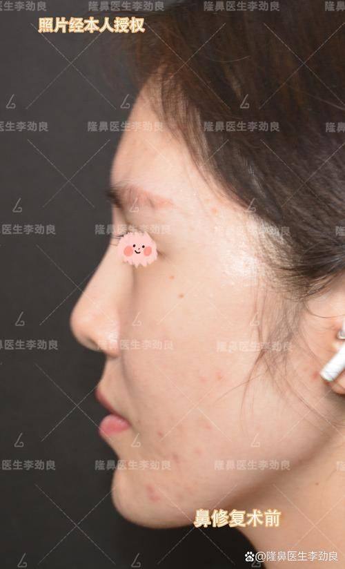 广州王莹医疗美容门诊部收费价格表/收费标准