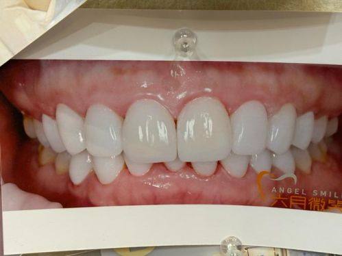 牙克石丰远口腔门诊部是正规医院吗?