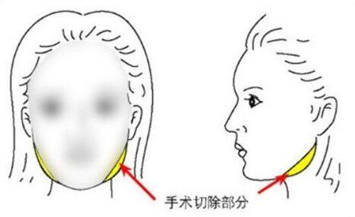 广州女子医院地址电话营业时间