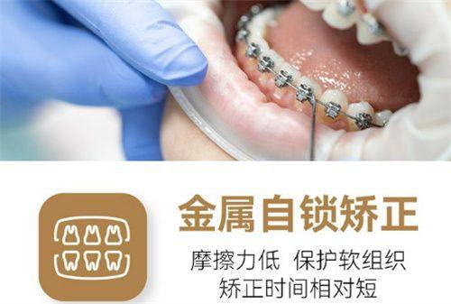 广东佛山黄仁李实青口腔收费价格表/收费标准