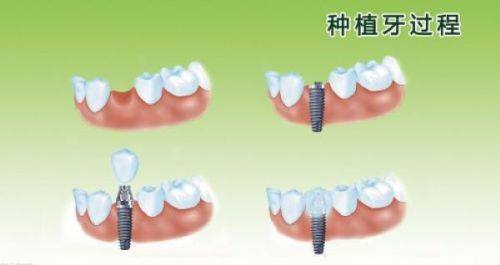 广东佛山黄仁李实青口腔地址电话营业时间