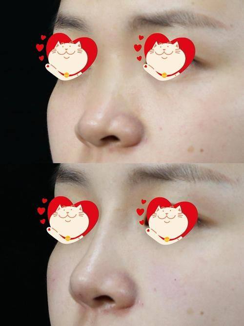 北京时珍堂医院医疗美容科是正规医院吗?