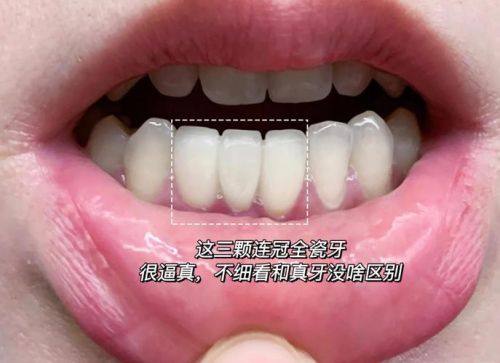 重庆开州罗永彬口腔收费价格表/收费标准