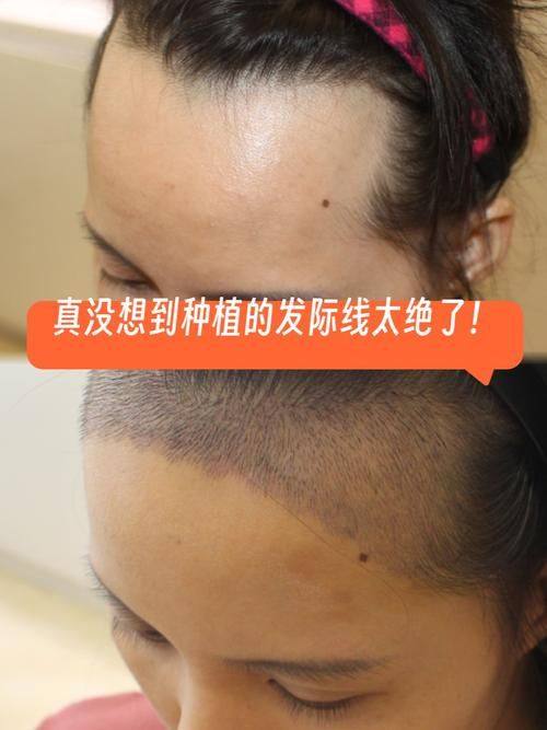 许昌丽娜整形医疗美容门诊部是正规医院吗？