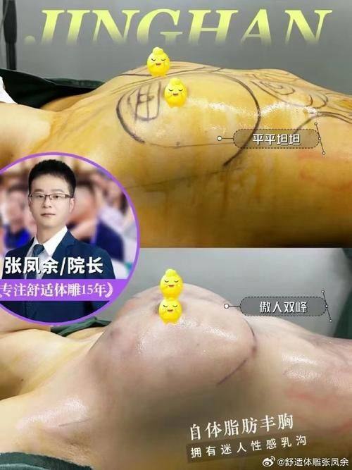 安阳市第五人民医院烧伤整形美容科特色项目及技术优势