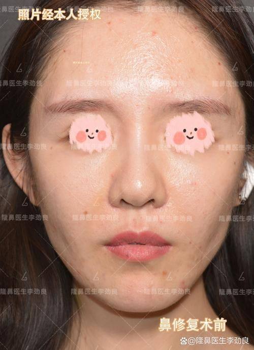 安阳市第五人民医院烧伤整形美容科收费价格表/收费标准