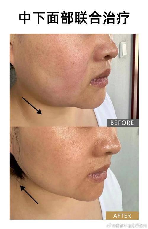 安阳市第五人民医院烧伤整形美容科地址电话营业时间