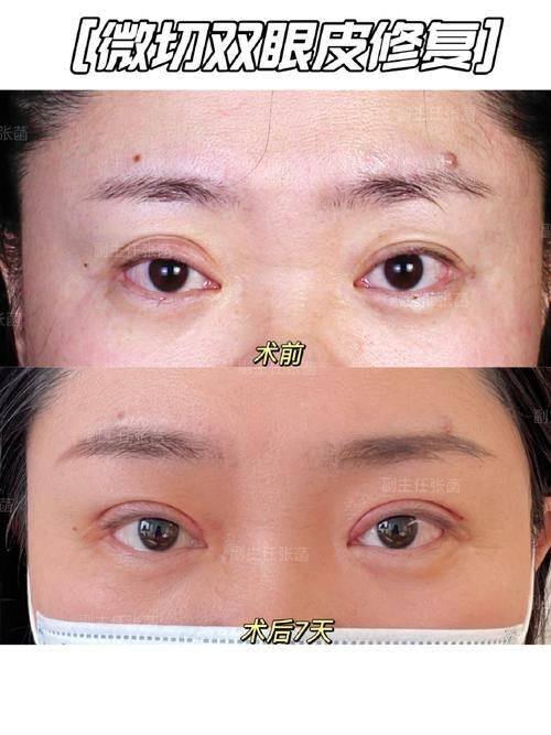 河北李美熊医疗美容真人口碑评价怎么样?