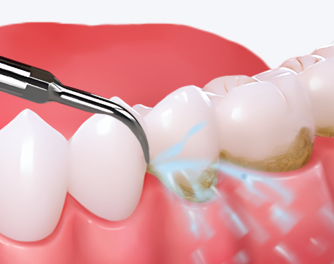 杭州修元口腔诊所（都市水乡）真人口碑评价怎么样？