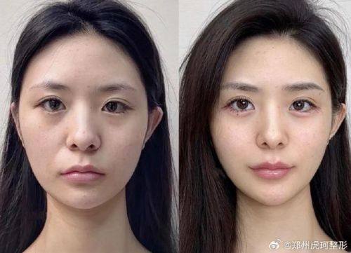 郑州乐医肤格整形医院收费价格表/收费标准