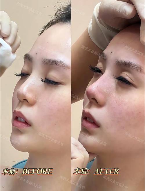 韩国yaan微整形外科医生团队实力强大及骨干医生简介