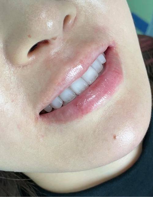 南充德尚口腔诊所真人口碑评价怎么样?