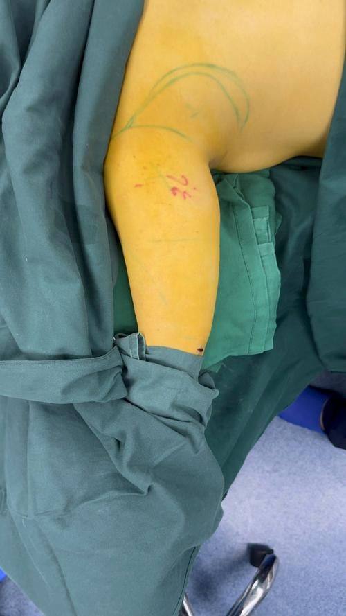 长沙韩臻整形医院详细的预约挂号方式及流程