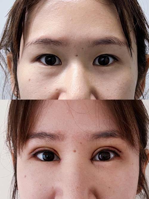 韩国yaan微整形外科是正规医院吗?