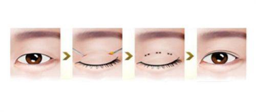 常德华 山医院整形美容中 心地址电话营业时间