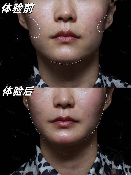 北京德美诊联医疗美容诊所真人口碑评价怎么样?