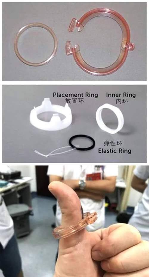 兰州友谊医院详细的预约挂号方式及流程