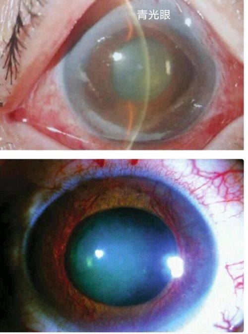 重庆市中医和西医结合眼科医院医生团队实力强大及骨干医生简介