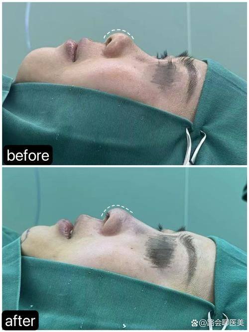 常德华 山医院整形美容中 心详细的预约挂号方式及流程